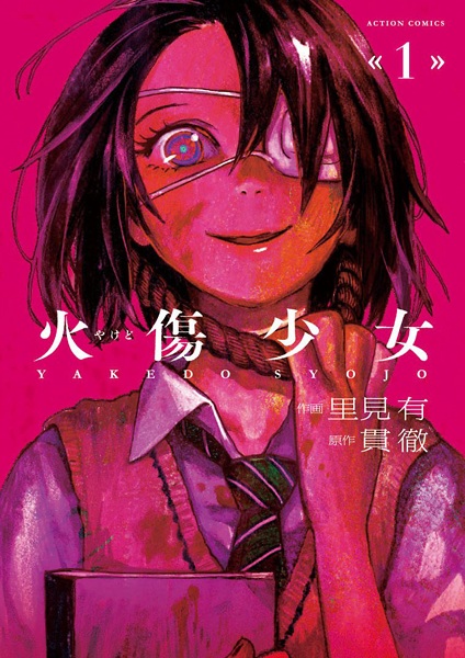 Yakedo Shoujo cover
